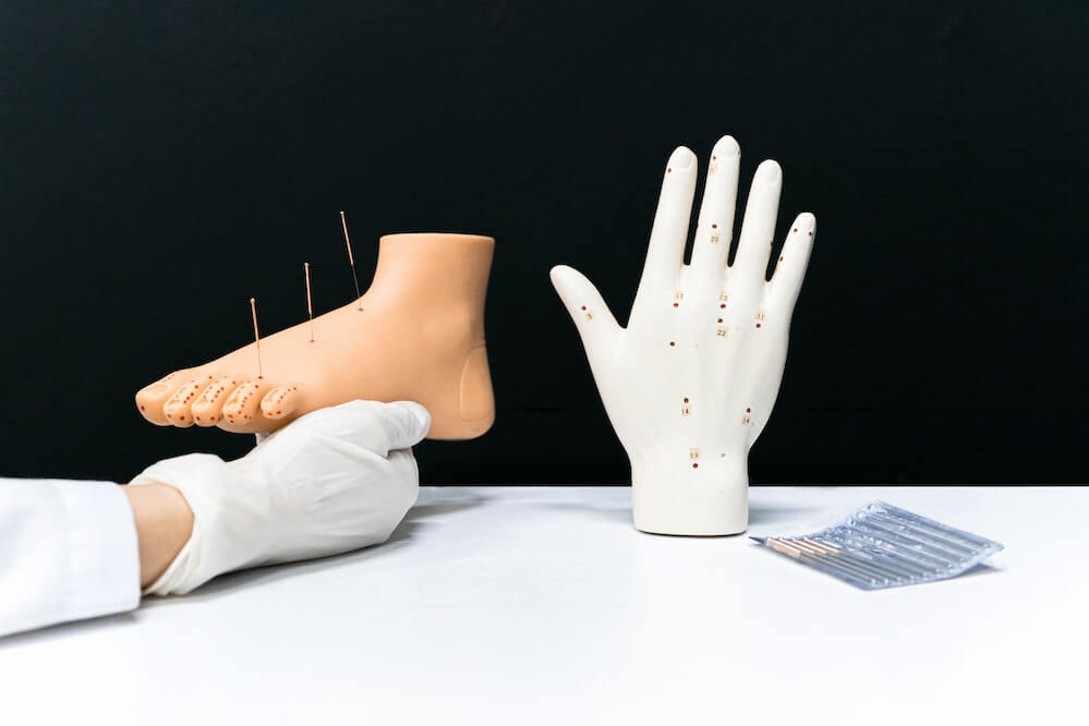 How to Treat Plantar Fasciitis with Acupuncture and TCM – Makari Wellness